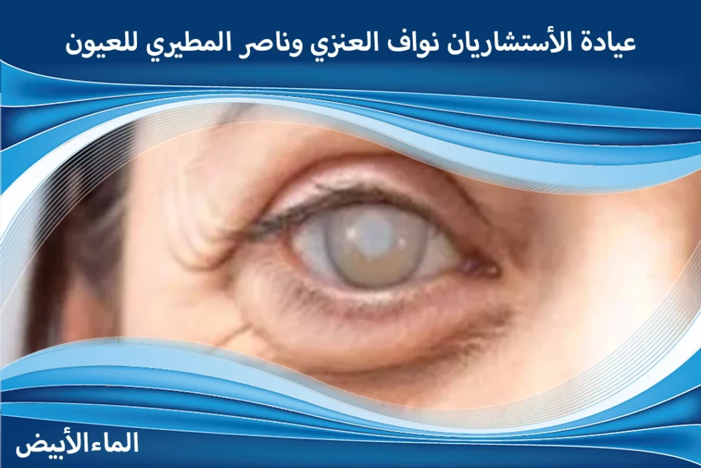 تكلفة عملية المياه البيضاء في الرياض
