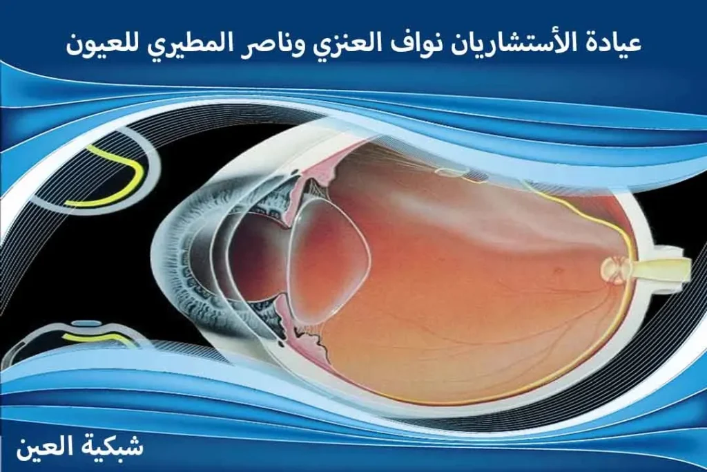 عروض عملية انفصال الشبكية