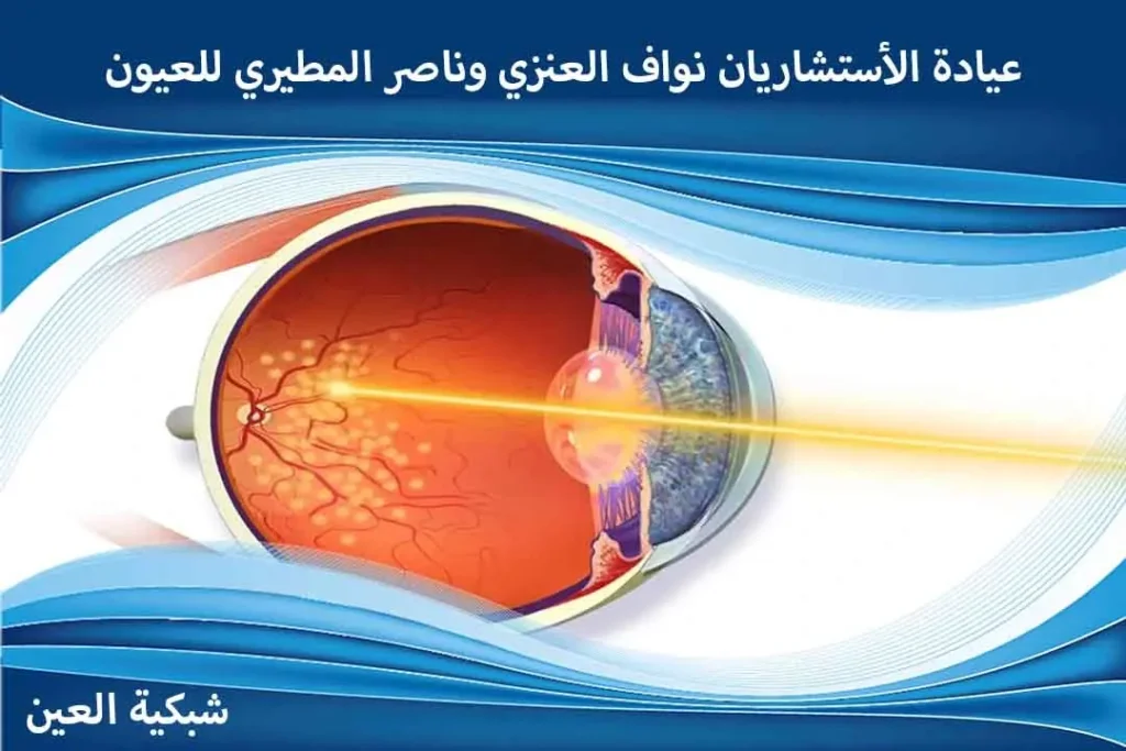 عروض عملية انفصال الشبكية