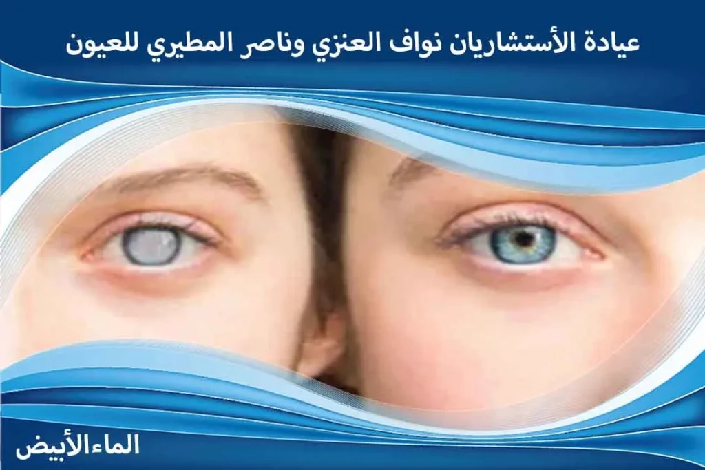 إزالة الماء الأبيض