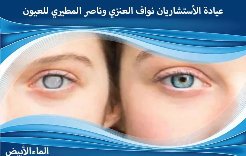 عروض اليوم الوطني لعملية ازالة المياه البيضاء