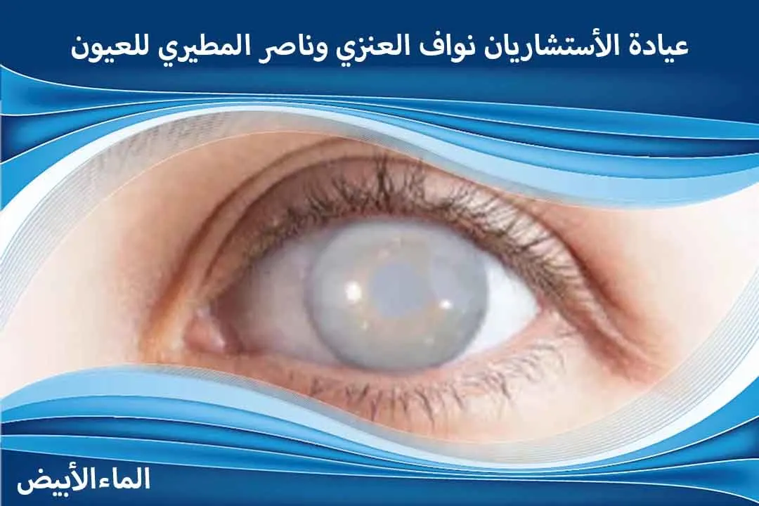 إزالة الماء الأبيض
