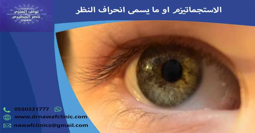 الاستجماتيزم
انحراف النظر
ما هو انحراف النظر
ما هو الاستجماتيزم