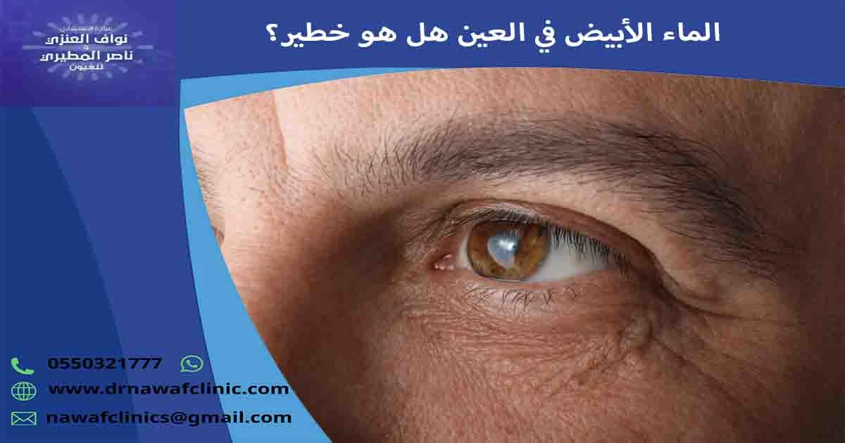 الماء الأبيض في العين هل هو خطير؟ هل الماء الأبيض في العين خطير؟ ما خطورة المياه البيضاء على العين؟