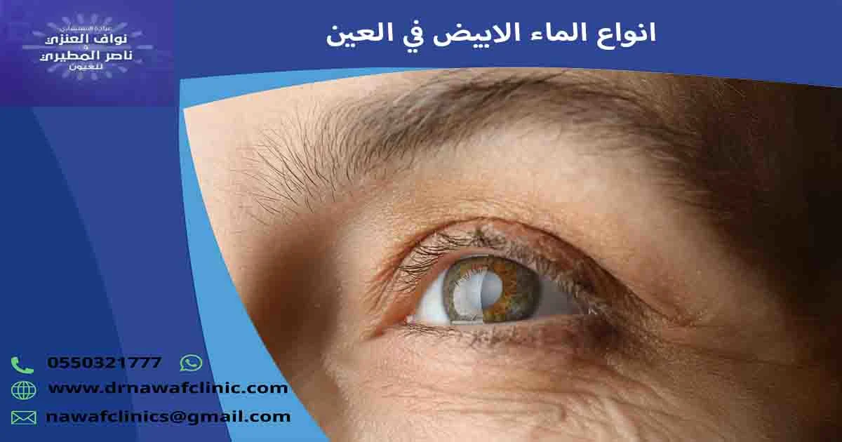 انواع الماء الابيض في العين أنواع إعتام عدسة العين