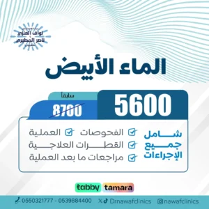 الماء الابيض