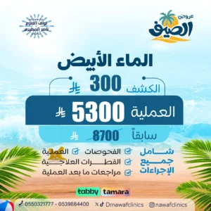 عرض الماء الابيض