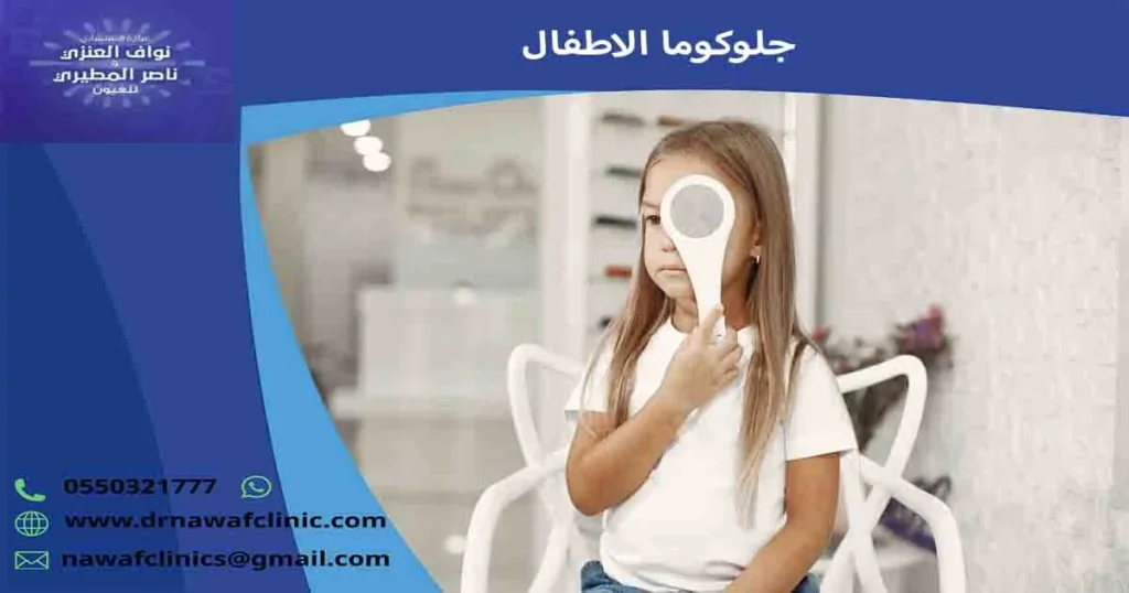 جلوكوما الاطفال
المياه الزرقاء في العين عند الاطفال
الجلوكوما عند حديثي الولادة