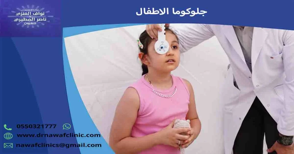 جلوكوما الاطفال
المياه الزرقاء في العين عند الاطفال
الجلوكوما عند حديثي الولادة