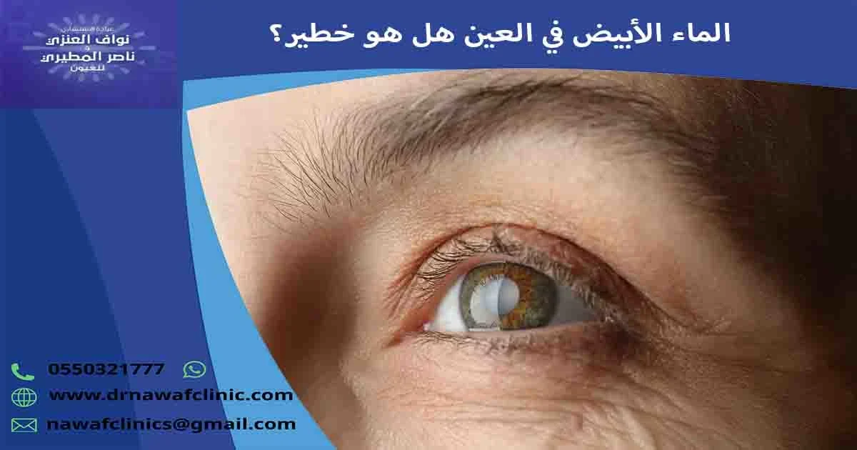 الماء الأبيض في العين هل هو خطير؟ هل الماء الأبيض في العين خطير؟ ما خطورة المياه البيضاء على العين؟